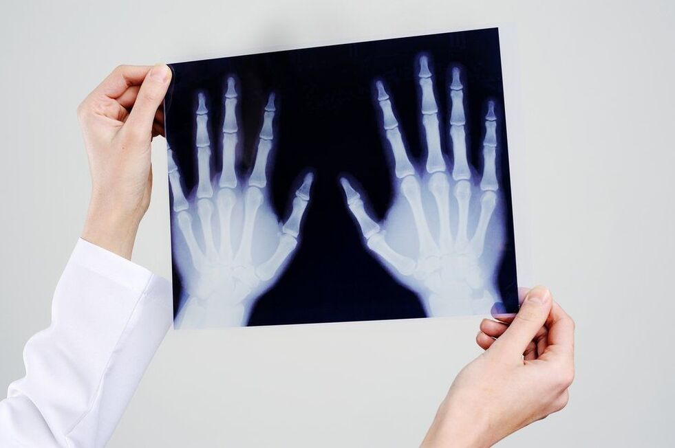 käte liigeste diagnostika